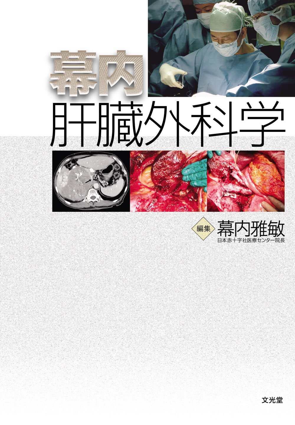 幕内肝臓外科学　幕内雅敏 Amazon.co.jp: 幕内肝臓外科学 : 幕内 雅敏: 本